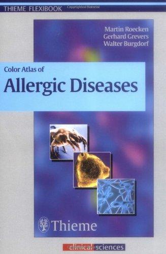 Color Atlas of Allergic Diseases                                                                                                                      <br><span class="capt-avtor"> By:Roecken, Martin                                   </span><br><span class="capt-pari"> Eur:19,50 Мкд:1199</span>